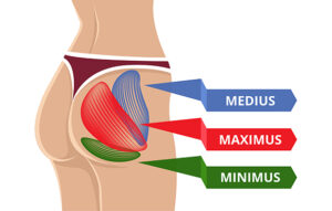 Diagram of gluteal muscles showing the maximus, medius and minimus