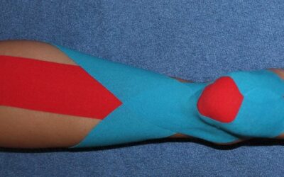 Kinesiology Taping for the Achilles Tendon