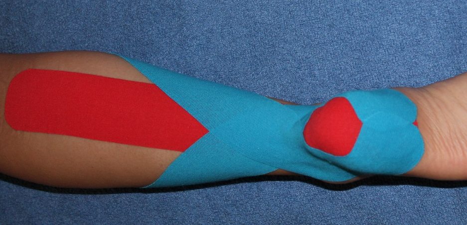 Final kinesiology taping of the achilles tendon